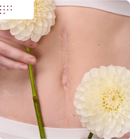 Benefits of rejuvenation and scar treatment
