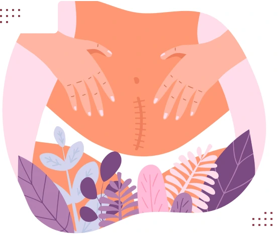 Steps for scar treatment