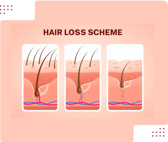 مراحل رشد و تقویت مو