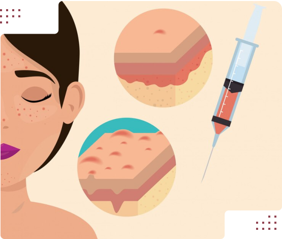 مراحل نانوفت