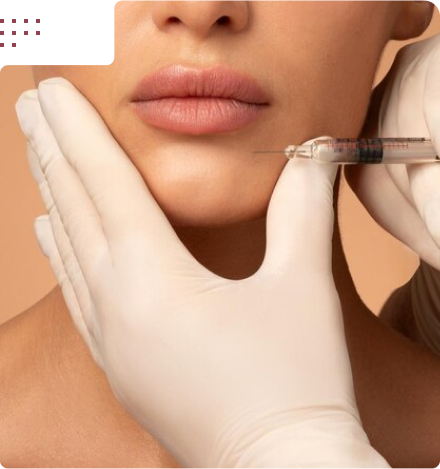 مزایای فیلر